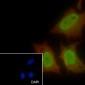 SF1 Recombinant Rabbit mAb